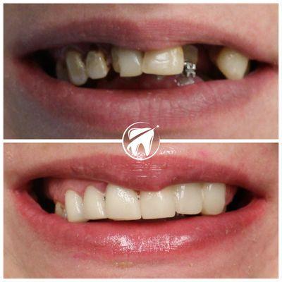 "We are delighted to share the amazing results achieved by this patient after their dental treatment.