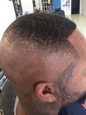 Bald Fade