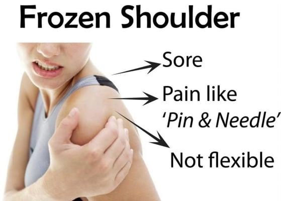 Frozen shoulder is commonly seen at my clinic.