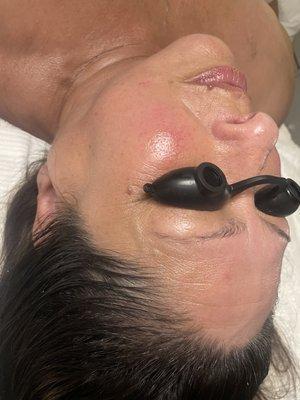 Anti Aging Contour Facial & Facial Cuppping