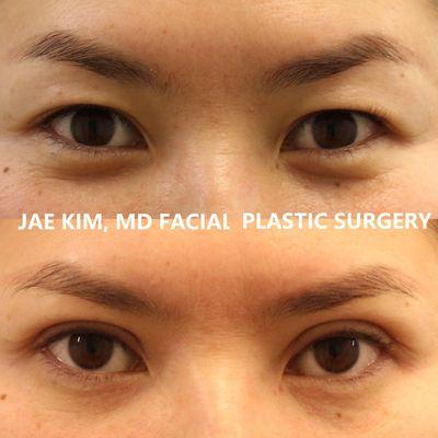 Jae Kim, MD Facial Plastic Surgery