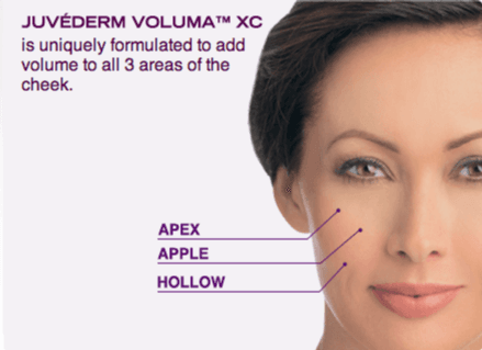 Area's Voluma can treat