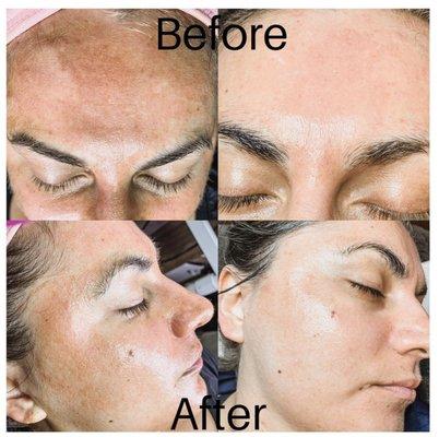 Amazing before and after results!