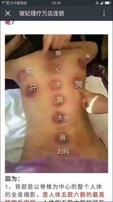 Chinese Clove Clinic