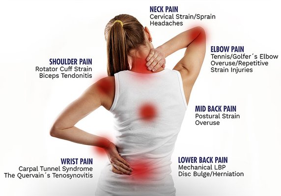 Upper Cross Syndrome