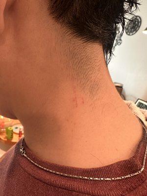 More cuts on neck from clippers