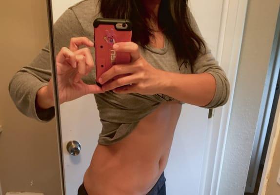 Flat stomach after first treatment