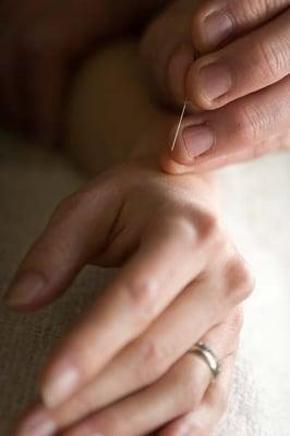 Acupuncture stimulates the body's innate healing response.