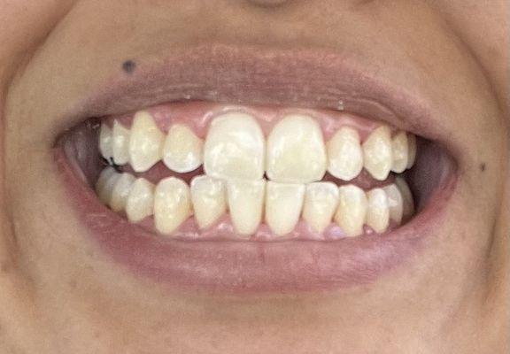 AFTER...dental cleaning.