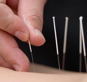 Acupuncture At Work!