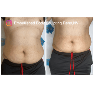 Embellished Body Sculpting & Aesthetics