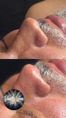 Gentlemen's facial