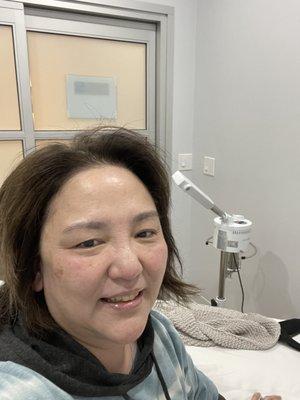 Another pic after a hydrojelly facial!