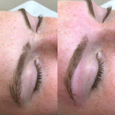 Brow transformation.