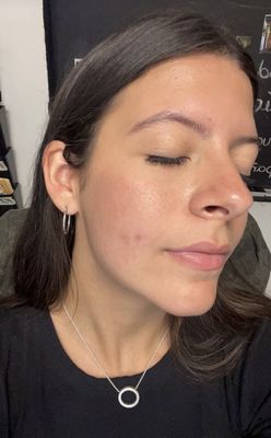 Skin after facial