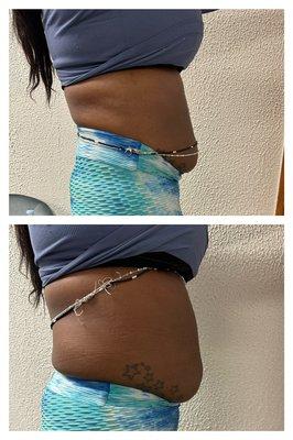 Results from 360 Lipo session.