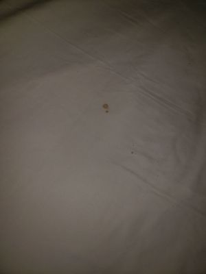 Blood stains on sheets.