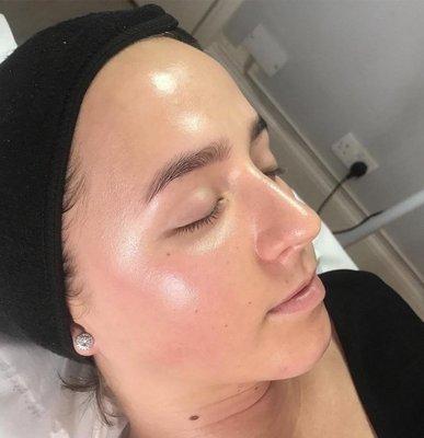 Skin has that amazing glow after a facial treatment!