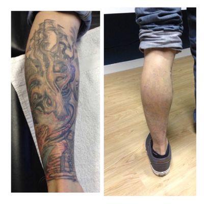 We almost finished on this client's leg.