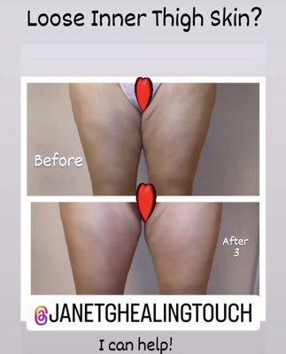 @janetshealingtouch body sculpting