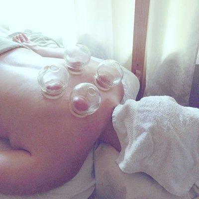 Cupping, Pain Relief, Myofascial work