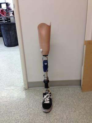 Elevated Vacuum Above knee prosthesis