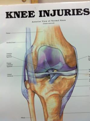 Knee Injuries