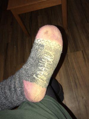 Bottom of my socks from walking in the room. They're supposed to be grey btw.