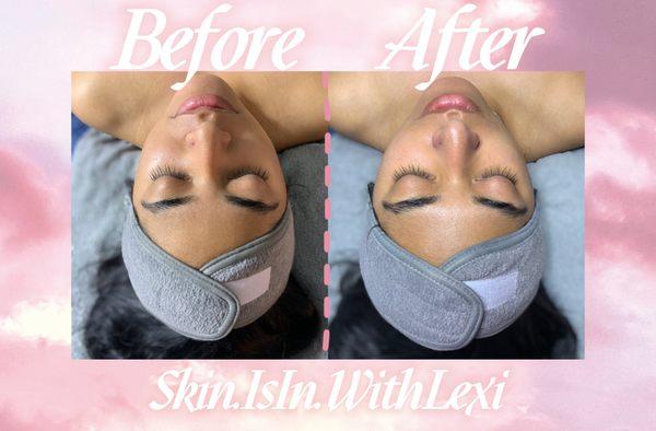 Detox Facial