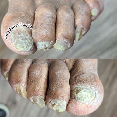 Before waterless pedicure