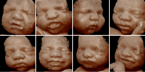 4D Realistic View exclusively at Over the Womb