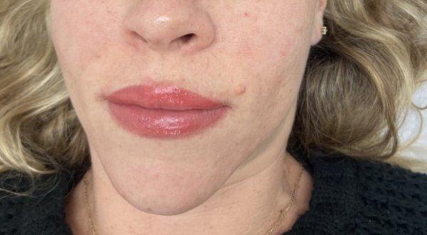 Cosmetic tattoo of the lips that enhances the beauty of the natural lip color, improving the shape and definition of  the lips