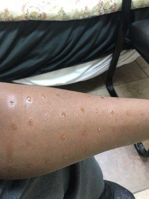 Allergy test