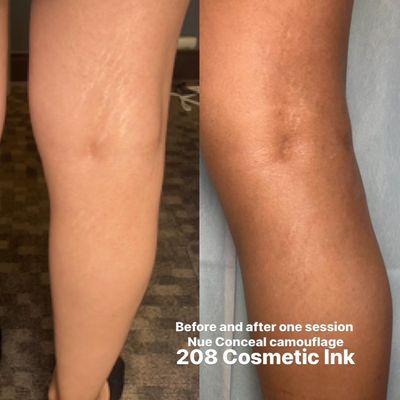 Before and after ONE session Nue Conceal stretch mark camouflage. Certified Nue Conceal artist. Boise, Idaho.