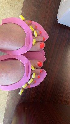 Painted toes