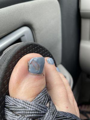 The nail chipped over night. And I had to drive 45 minutes to get it fixed