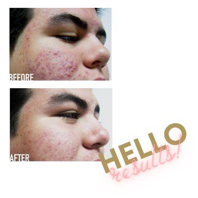 The Beez Kneez Skin Care and Acne Clinic