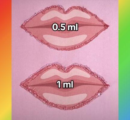 Lip fillers - Make the best choice . Say NO to #overfill