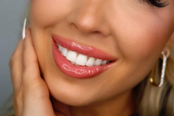 Professional teeth whitening