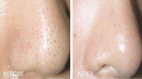 Minimize pores keeping them clean :)