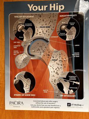 Enlarged hip diagram