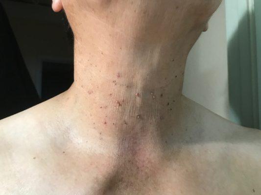 Husband's neck.