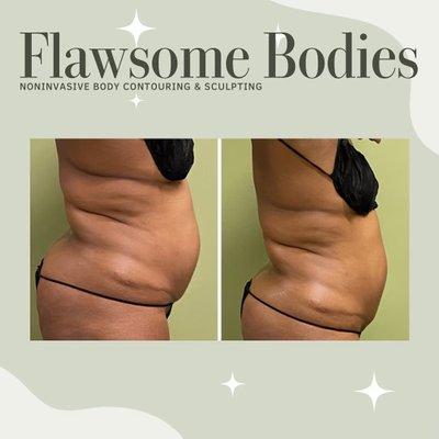 Flawsome Bodies