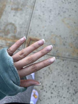 My poor hands after a "soak off"