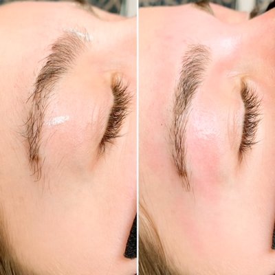 Before & After Eyebrow Shaping