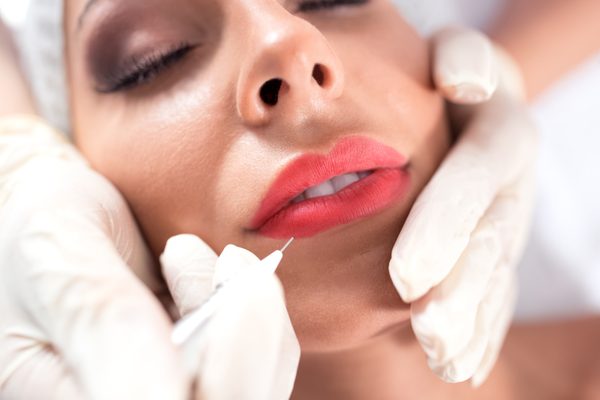 Lip Fillers to create very SMOOCH-able Lips.