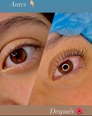 Lash Lift | Levantamiento de Pestañas