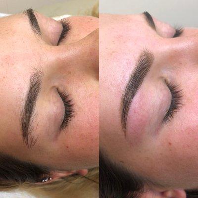 Brow transformation.