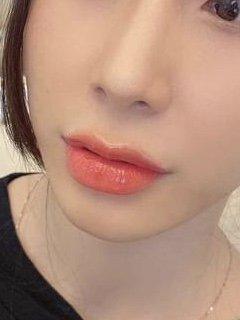 Heart shape lips filler