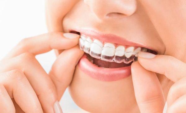 Repair your smile with dental crowns and bridges in Jacksonville! Our dentist provides affordable teeth restoration to improve your smile.